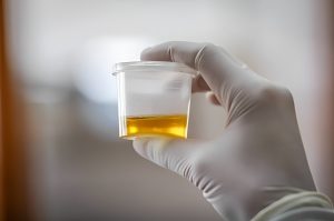 Synthetic Urine